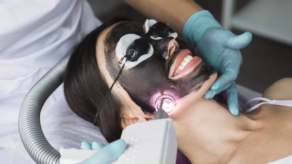 Carbon laser peel imagery published by Anima Med Spa