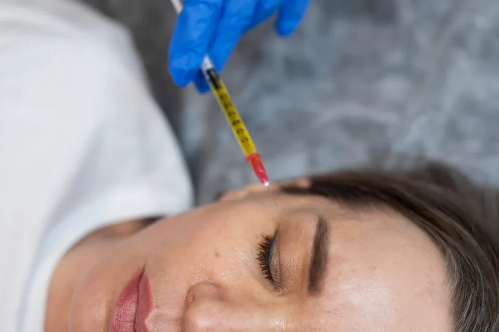 PRP skin rejuvenation imagery published by Anima Med Spa